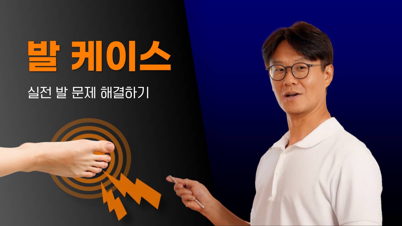 발 케이스 스터디