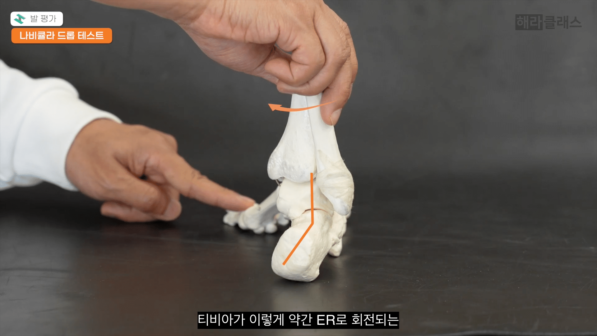 CASE 04 After — 親指を上げるだけでアーチが自然に上がる